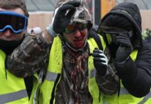 Γαλλία: Συγκλονιστική περιγραφή διαδηλωτή που κινδυνεύει να χάσει το χέρι του χέρι